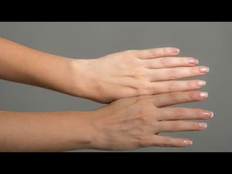 Cómo aclarar la piel de las manos y los pies